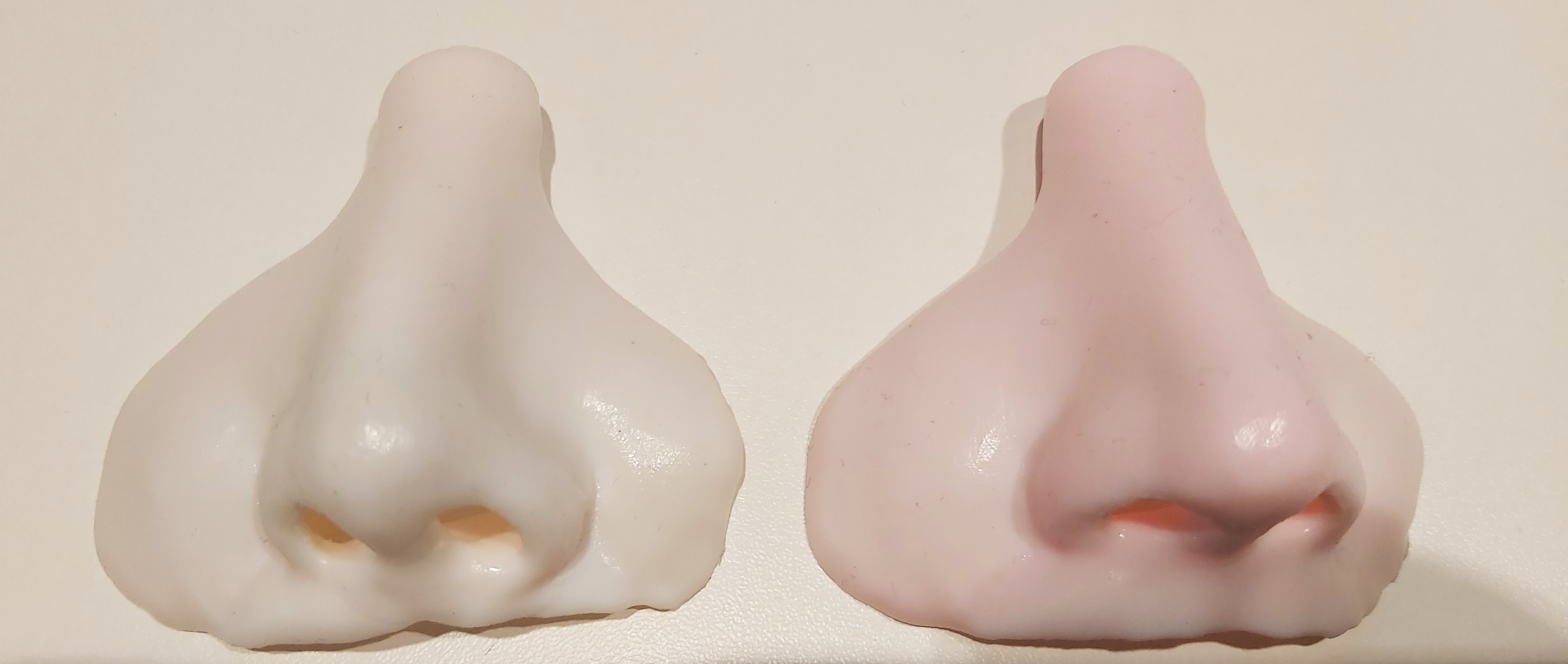 Facial Prosthesis